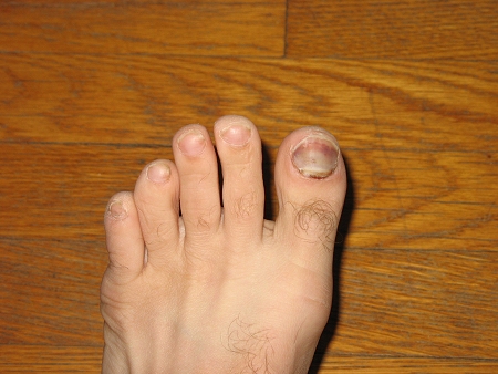 The Toe